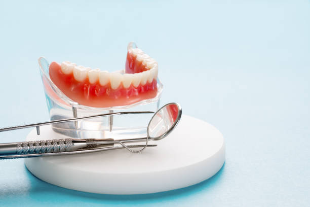 Full Mouth Reconstruction in Grayson Valley, AL